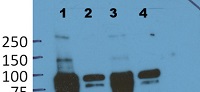 EIN2 | Ethylene insensitive 2 in the group Antibodies Plant/Algal / Hormones / Biosynthesis/regulation at Agrisera AB (Antibodies for research) (AS12 1865)